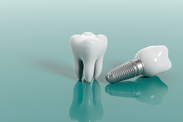 Cosmetic Dental Services Options With Implants from Founders Dental in Castle Rock, CO