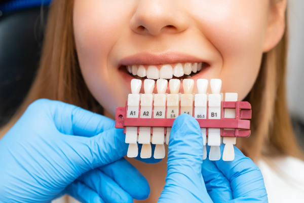 How To Care For Dental Veneers