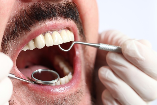 The Real Cost Of Delaying Tooth Replacement